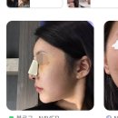 얄라코리아