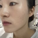 상모제일약국 | &lt;6월 뷰티 내돈내산 찐후기&gt; 제로이드, 아토베리어, 브링그린, 노스카나, 페리페라, 듀이트리, 바닐라코...