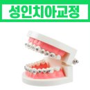 대야치과의원 네이버블로그