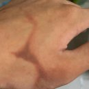 브이유의원 | 세종시 고운동 피부과 전문 병원 추천 BEST 6곳