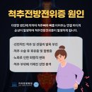 김포신경외과 척추전방전위증 여성에게서 높은 발병율을 보이는 이유는? 이미지