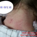 임브레이스 이미지
