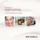 스킨엔젤라 이미지