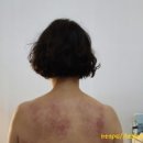 몽힐링케어 이미지