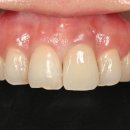 광교탑치과의원 이미지