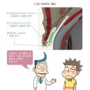 질병수술Ⅱ(선천 포함,경증질병 제외)보장 특별약관과 질병수술Ⅱ(선천 포함)보장 특별약관의 "보험금을 지급하지 않는 사유" 비교 이미지