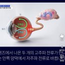 憂鬱症 治療 lens 이미지