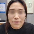 달서구 한방 코성형 교정 (김기호한의원)
