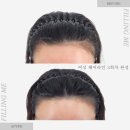 미가헤어라인 이미지