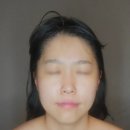 망포피부관리 몽스킨 써큘테라피 후기 (안면유지인대 관리)