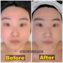 피부를 말하다 | 대전 뷰티샵 추천 쏜뷰티 피부 리프팅 데콜테 물방울 관리로 수분 탄력 광채 관리 한번에 받고 온 후기