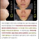 샘재로 3 | 헌 피부에서 새 피부로 변신! 장호원여드름관리(임상사진+후기)