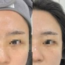 진주 모공관리는 &#39;임변진 이미지메이킹&#39;