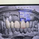 유일치과기공소 이미지