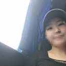 수포차 - 광진구 능동로36길 55 | 15년된 아이라인 문신 제거 1회차 내돈내산후기 Ι통증·붓기·멍 1주일동안 경과 사진 총정리Ι