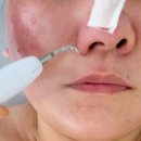 블랑드보떼 이미지