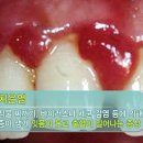 프렌즈치과 이미지