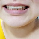 미르덴탈 이미지