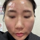 아로마가든 | 홍대 트러블관리 글로우가든 아로마YONKA 트러블케어 받아본 후기