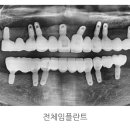 기아치과의원 네이버블로그