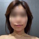 안양역 피부관리 골드스킨앤바디 뱀부테라피 후기
