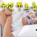 사암침, 사암침법 - 수면 무호흡증 치료 방법 - 비과학적 양의학 96 이미지