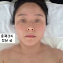 유에보에스테틱 | 대구 윤곽관리 꼼꼼하게 잘하는 유에보에스테틱 후기