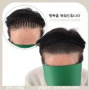 더 채움 스칼프