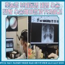 강남-245 | 강남이비인후과 쌍둥이 출산 후 시작된 비염 그리고 축농증까지 과연수술을 해야할까