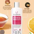 985 | 인생샴푸 등극! 비듬 두피 구원템 천연유래성분 985 약산성 샴푸 후기