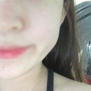 러쉬성형외과의원 | 강남 압구정 실리프팅 잘하는곳 애엄마 솔직 후기 (리얼 후기)