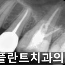 차플란트치과의원 이미지