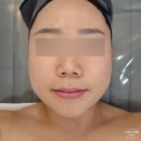 군산피부관리 듀에스테틱 머미케어 후기