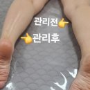 오늘은밝은피부 이미지