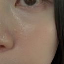 신사 벨로의원:: 잡티제거 듀얼토닝 후기, 딱지모드 1회만에 효과본 후기, 내돈내산 신사역 피부과