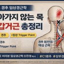 목이 돌아가지 않을 때 가장 먼저 봐야 할 근육 견갑거근(Levator Scapulae) 임상 완전 정리 이미지
