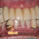 튼튼한치과의원 | 홍성내포치과 추천? 전문의가 드리는 솔직한 조언