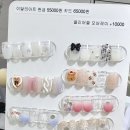 요온네일 이미지