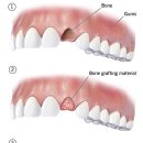 S.M.치과기공소 | 임플란트, 안 해도 될 때 안 한다고 말하는 치과가 있습니다 — 학술적인 내용만 전달합니다.