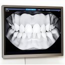 탑연합의원 | 헐, 내 치아 상태 알고 계셨나요?