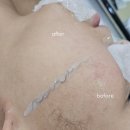 [전주스킨플래닝] 전주피부관리샵에서 스킨플래닝 제이무드뷰티 후기
