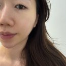 에스테틱 라포레 | 까치산 피부관리 제대로 받는 에스테틱, 라포레뷰티 물방울초음파리프팅 후기