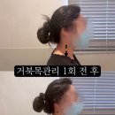 중동컴퓨터 | 창원 거북목 관리 [중동 여리한다이어트]재방문 후기