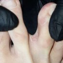 (주)케어윈스 | 라미실 원스 가격 추가 관리 꿀팁 후기