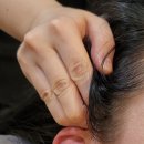 귀건강(이혈테라피) 이미지