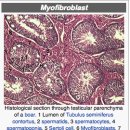 myofibroblast의 조직손상시 wound healing에 관여하는 기능 이미지