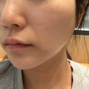 청담더맥한의원 | 압구정로데오피부과 고우리스킨부스터 청담오가나셀의원 본식 준비