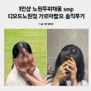 강북 노원두피 전문점 디모드 smp로 여성형 가르마 탈모 두피채움 솔직후기