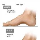 엔브이 이미지