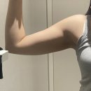 팔뚝 바디온다리프팅 싹주사 후기 효과 멍